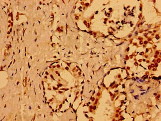 NUMA1 / NUMA Antibody