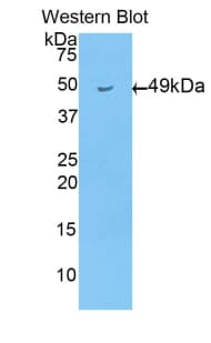 APOD / Apolipoprotein D Antibody (aa1-189)