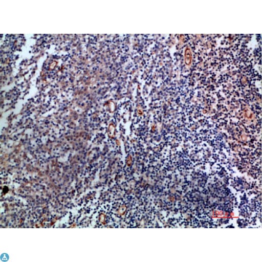 CD105 Antibody