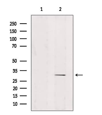 ZNF498 Antibody