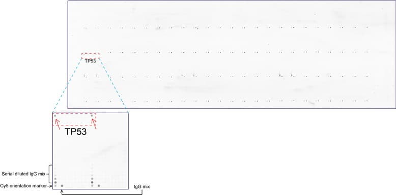 Monoclonal Mouse anti-Human TP53 / p53 Antibody (clone UMAB62, IHC, IF, WB)