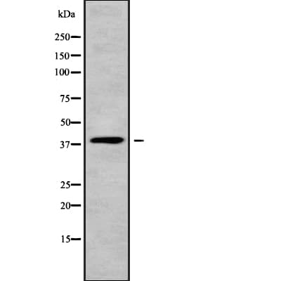Polyclonal Rabbit anti-Human MOGAT3 Antibody (WB)