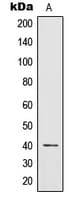 Polyclonal Rabbit anti-Human IL12B / IL12 p40 Antibody (Internal, WB)