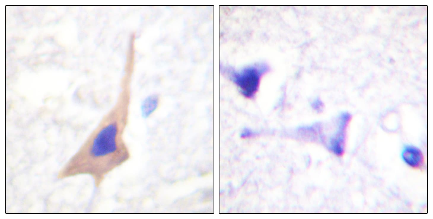 Polyclonal Rabbit anti-Human TPH1 / Tryptophan Hydroxylase Antibody (phospho-Ser58, IHC, WB)