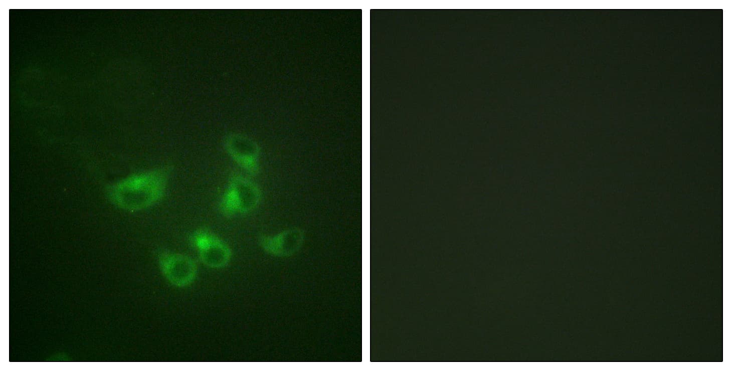 PathPlus™ TPH1 / Tryptophan Hydroxylase Antibody (aa26-75)