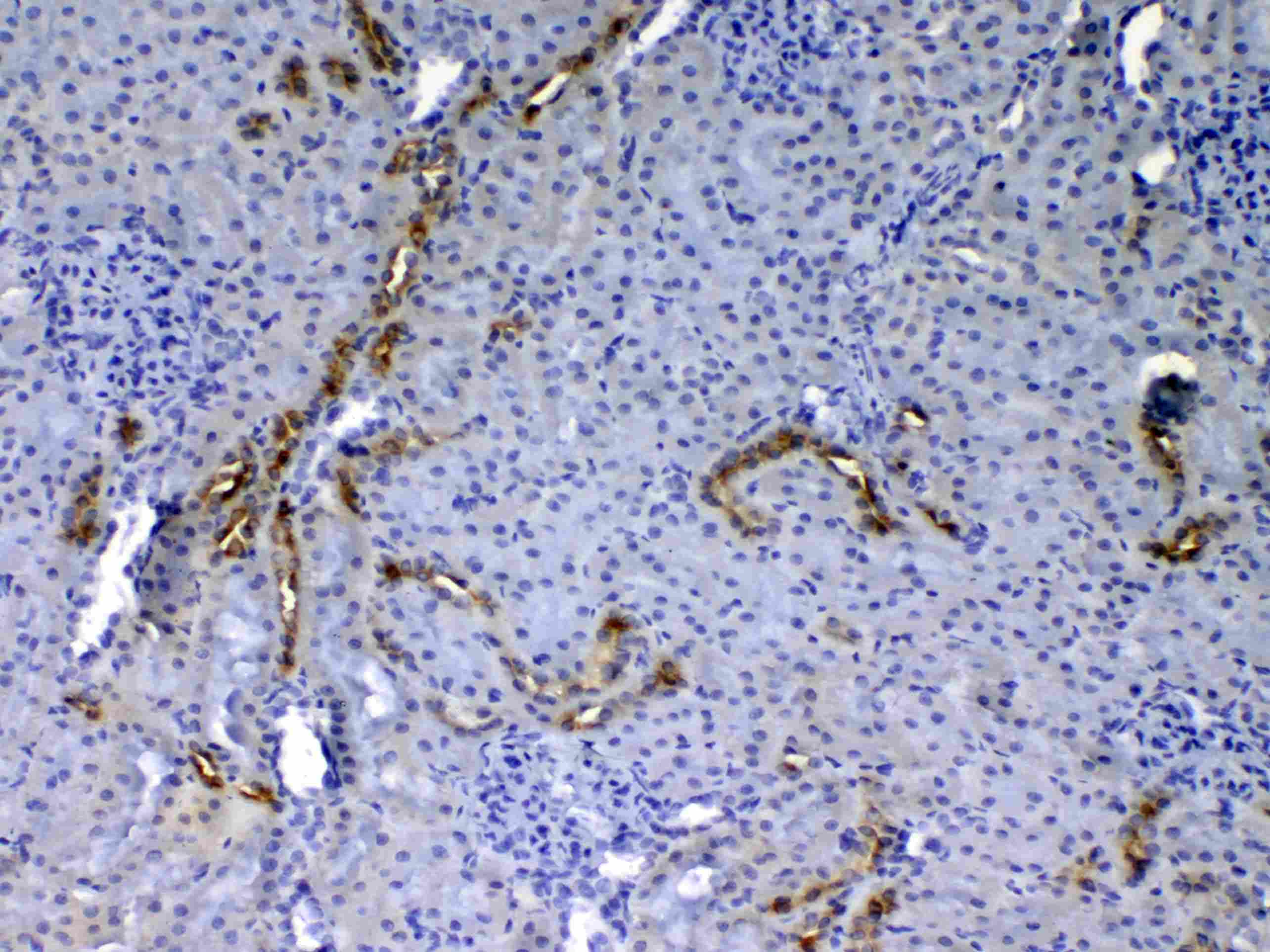 Polyclonal Rabbit anti-Rat EGF Antibody (IHC, WB)