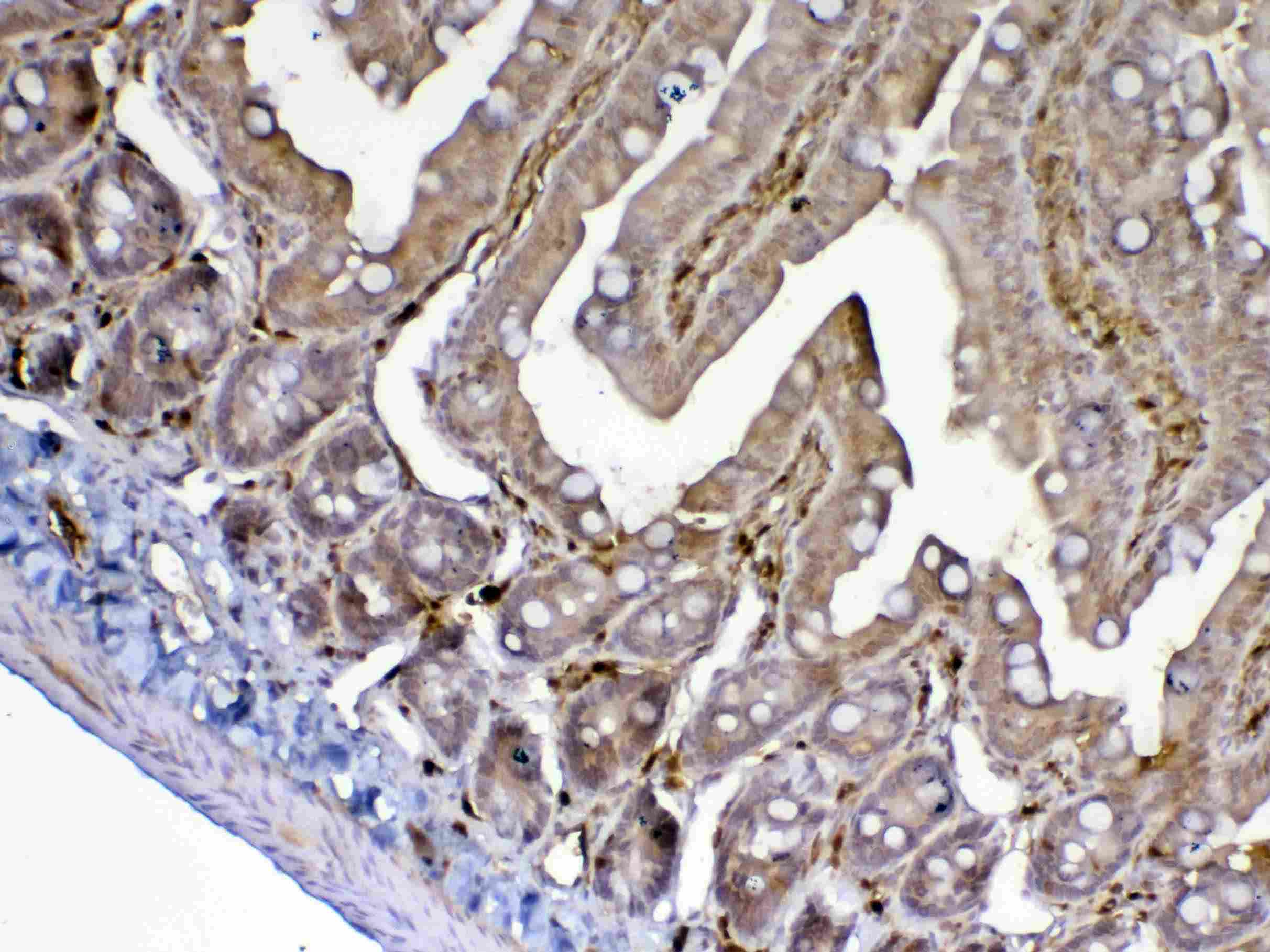 ADA / Adenosine Deaminase Antibody