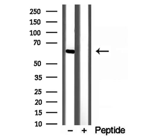 YTHDF2 Antibody