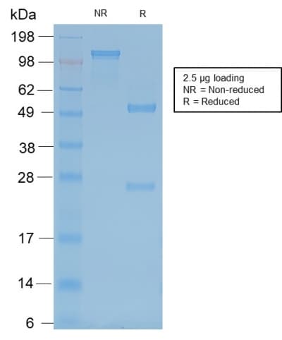 NEFH / NF-H Antibody (clone rNF421)