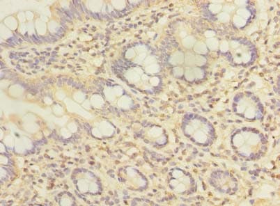 Polyclonal Rabbit anti-Human ZFAND2A Antibody (IHC)