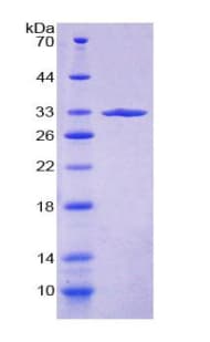Human Alpha Fucosidase / FUCA1 Protein (Recombinant His-T7)