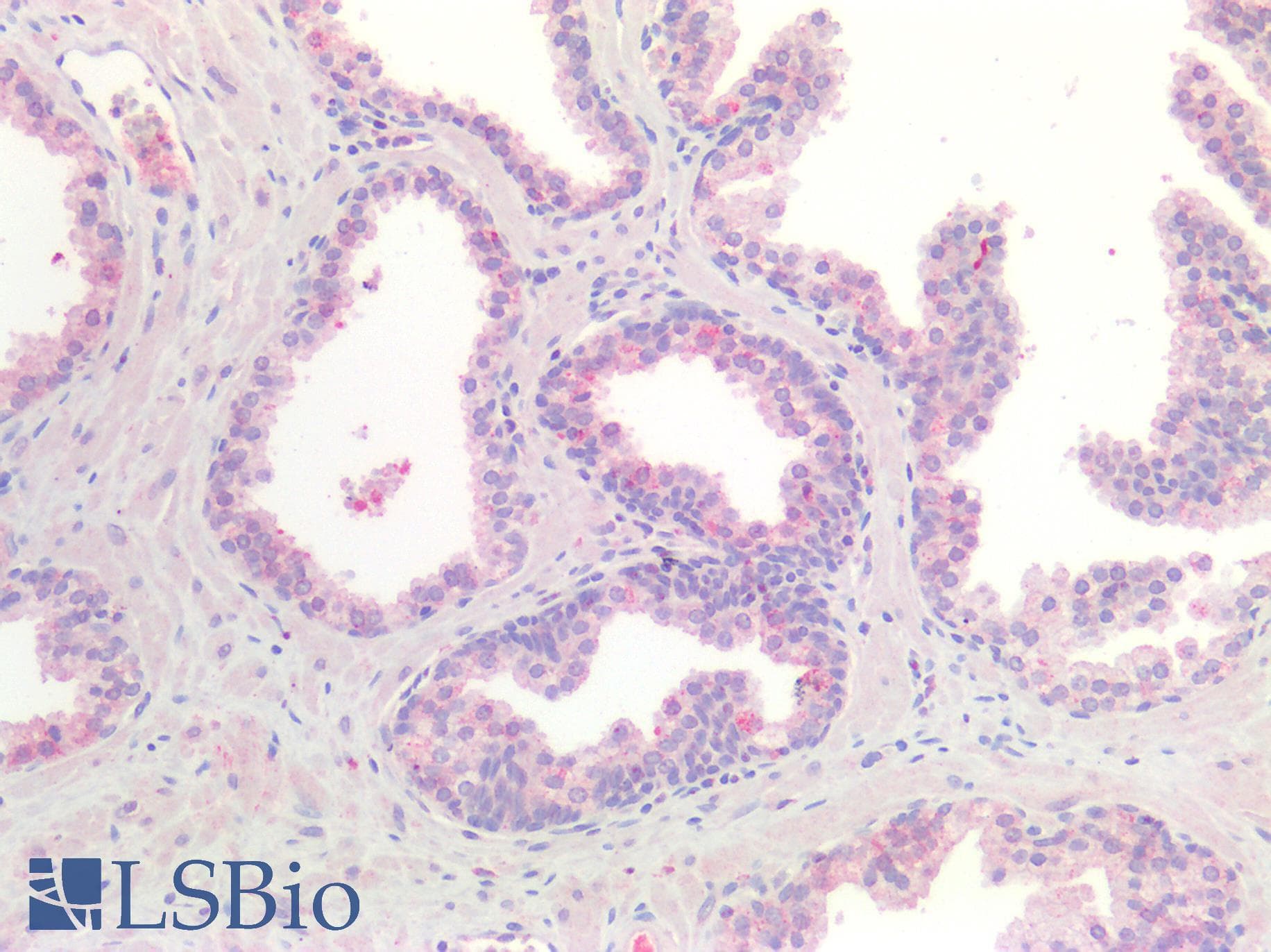 PathPlus™ Polyclonal Rabbit anti-Human 5-Alpha Reductase / SRD5A1 Antibody (IHC)