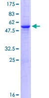 Human CTDSP1 / SCP1 Protein (Recombinant GST)