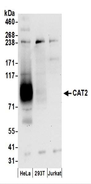 IHC-plus™ SLC7A2 Antibody (aa608-658)