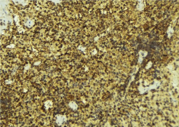 NR0B2 Antibody