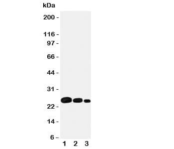 Polyclonal Rabbit anti-Human Adiponectin Antibody (aa224-244, IHC, WB)