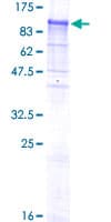 Human NELL1 Protein (Recombinant GST)