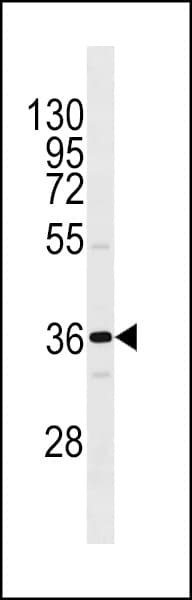 Polyclonal Rabbit anti-Human OR1I1 Antibody (aa1-30, WB)