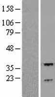 RGS3 Protein (Over-Expression Lysate Myc-DDK (Flag))