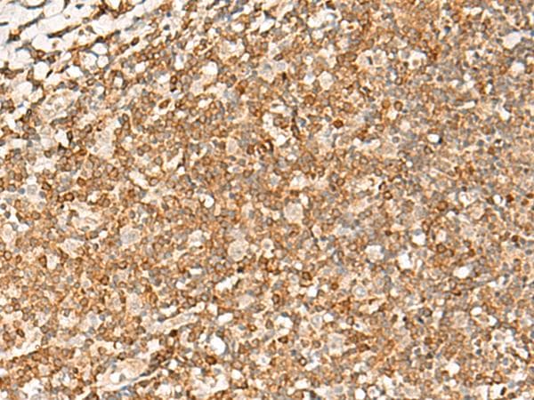 PDCD4 Antibody