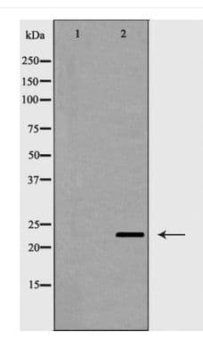 CD83 Antibody