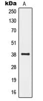 Polyclonal Rabbit anti-Human GPR20 Antibody (C-Terminus, IHC, WB)