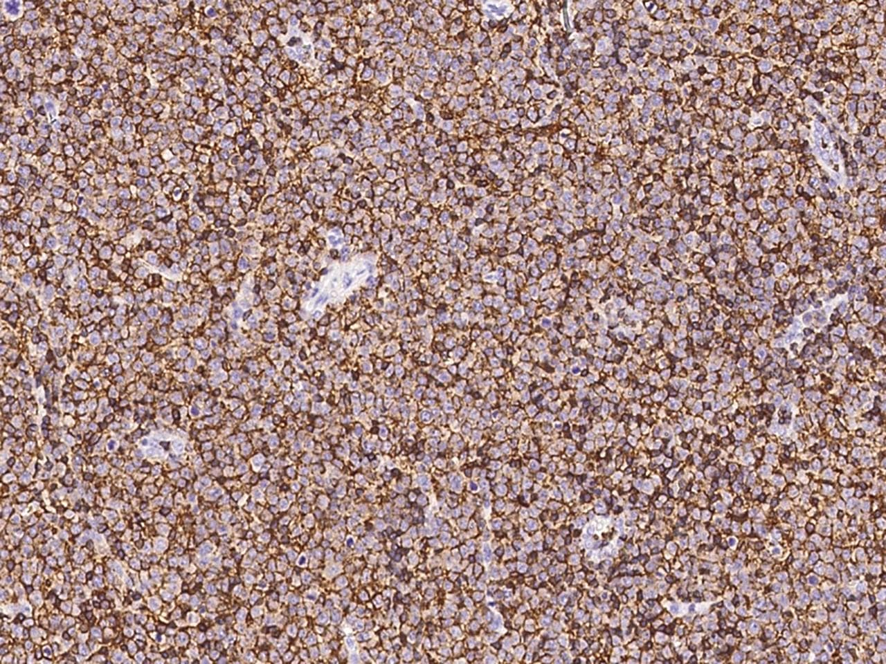 Monoclonal Rabbit anti-Human CD45 / LCA Antibody (clone 145, Preservative Free, IHC)