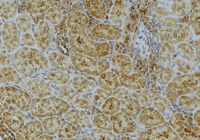 Polyclonal Rabbit anti-Human UGT2B7 Antibody (IHC, IF, WB)