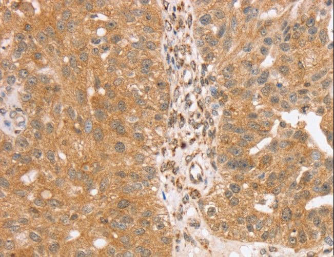 TRIM25 Antibody