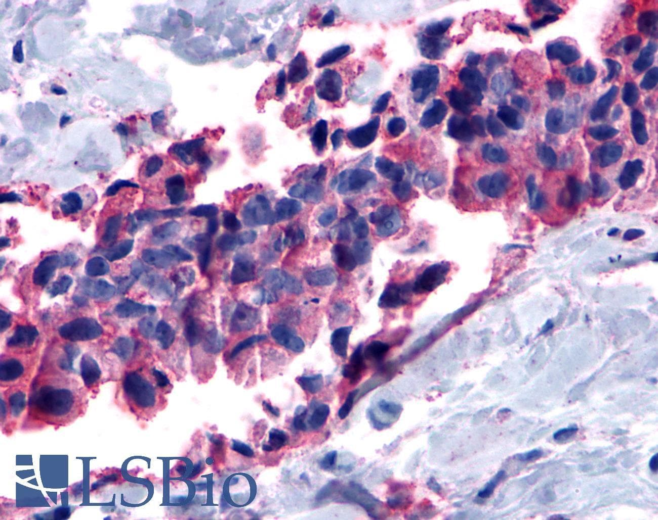 IHC-plus™ MC1R Antibody (Cytoplasmic Domain)