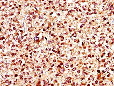 Polyclonal Rabbit anti-Human KCNJ10 / SESAME / KIR4.1 Antibody (aa165-379, IHC)