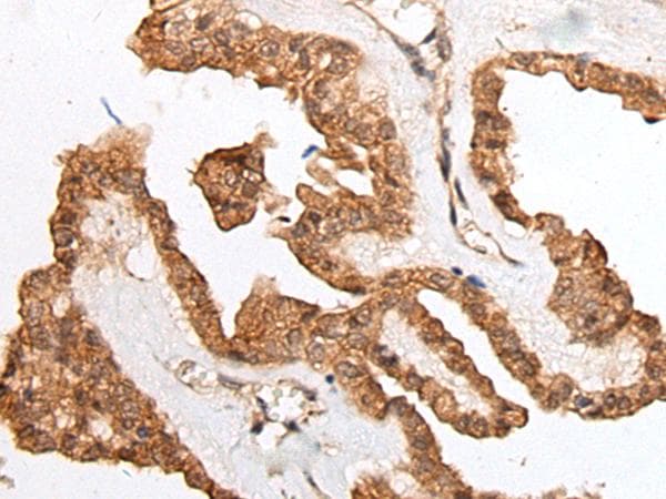 HOXB9 Antibody