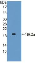 HBA1+2 / Hemoglobin Alpha Antibody (aa1-142)