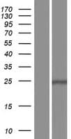 COQ7 Protein (Over-Expression Lysate Myc-DDK (Flag))