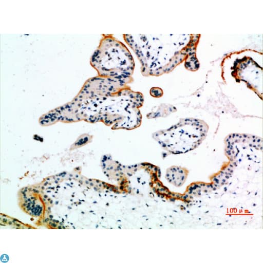 EDNRB / Endothelin B Receptor Antibody