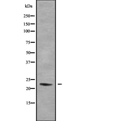 DUX5 Antibody