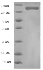 Human HRH1 / Histamine H1 Receptor Protein (Recombinant 6His, N-terminus)