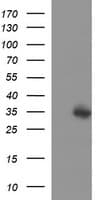 Monoclonal Mouse anti-Human TXNDC1 / TMX1 Antibody (clone OTI1D8, WB)