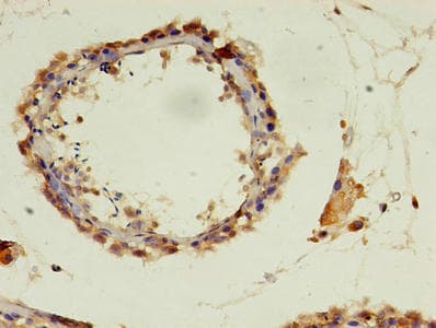 Polyclonal Rabbit anti-Human POLR3A Antibody (aa392-632, IHC)
