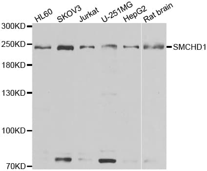 Polyclonal Rabbit anti-Human SMCHD1 Antibody (IHC, IF, WB)