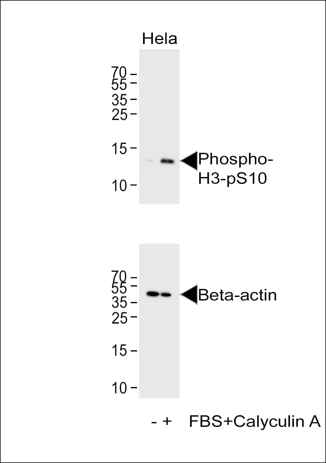 Polyclonal Rabbit anti-Human HIST1H3E Antibody (phospho-Ser10, IHC, WB)