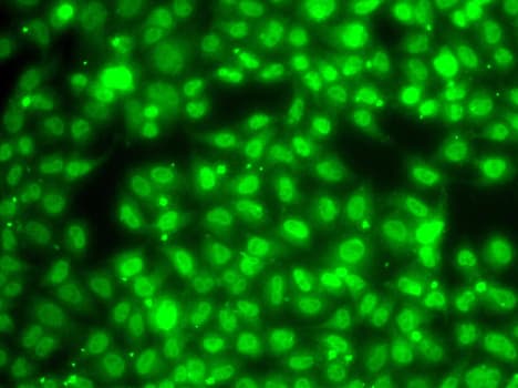ZNF264 Antibody