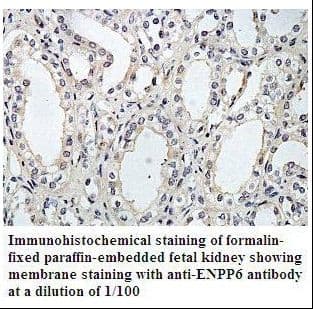 Polyclonal Rabbit anti-Human CD39 Antibody (aa374-551, IHC, WB)