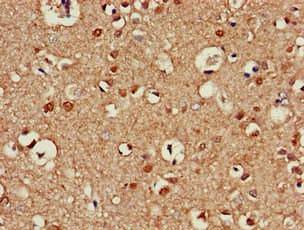 KIAA0652 / ATG13 Antibody