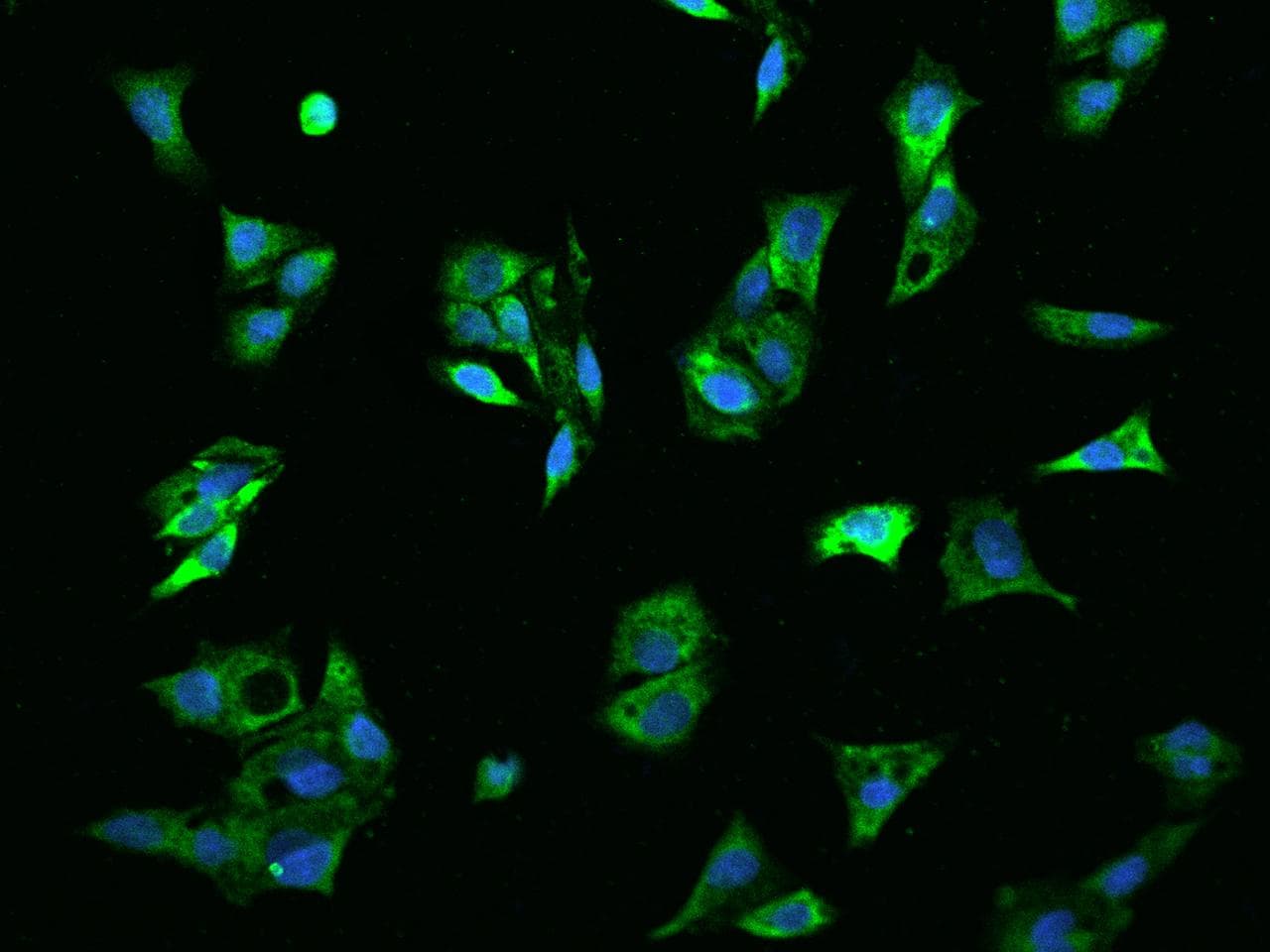 ADAMTS13 Antibody