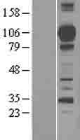 MASP1 / MASP Protein (Over-Expression Lysate Myc-DDK (Flag))