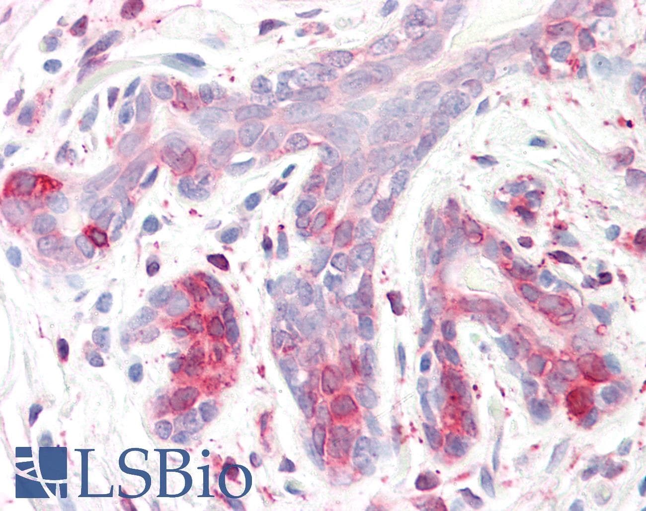 IHC-plus™ SPFH2 / ERLIN2 Antibody (aa328-339)