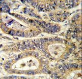IGFBP6 Antibody (aa176-200)