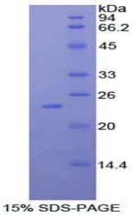 Human IFN Beta / Interferon Beta Protein (Recombinant His-T7)