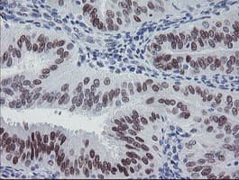 MEIS3 Antibody (aa1-261, clone OTI3E12, Carrier-free)